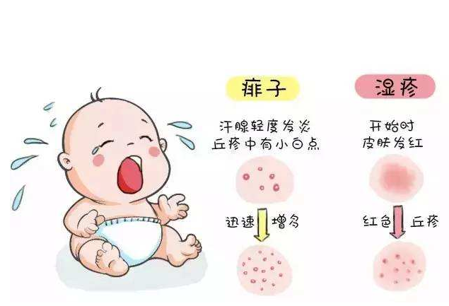 白斑病治疗费用大概是多少